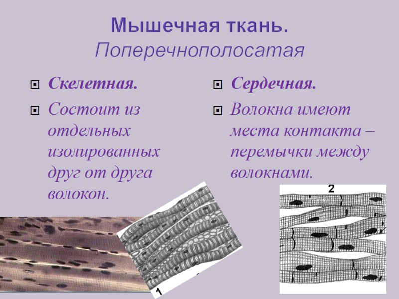 Мышечная ткань. Поперечнополосатая  Скелетная. Состоит из отдельных изолированных друг от друга волокон. Сердечная.